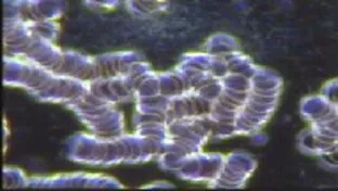 Dark field microscopy showing red cells stacked in chains with fibrin strands