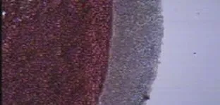Light field microscopy of a dried blood sample with a grey band along its edge
