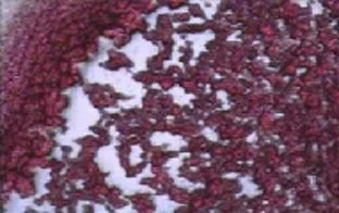 Light field microscopy of a dried blood sample showing pale gaps described as white lakes