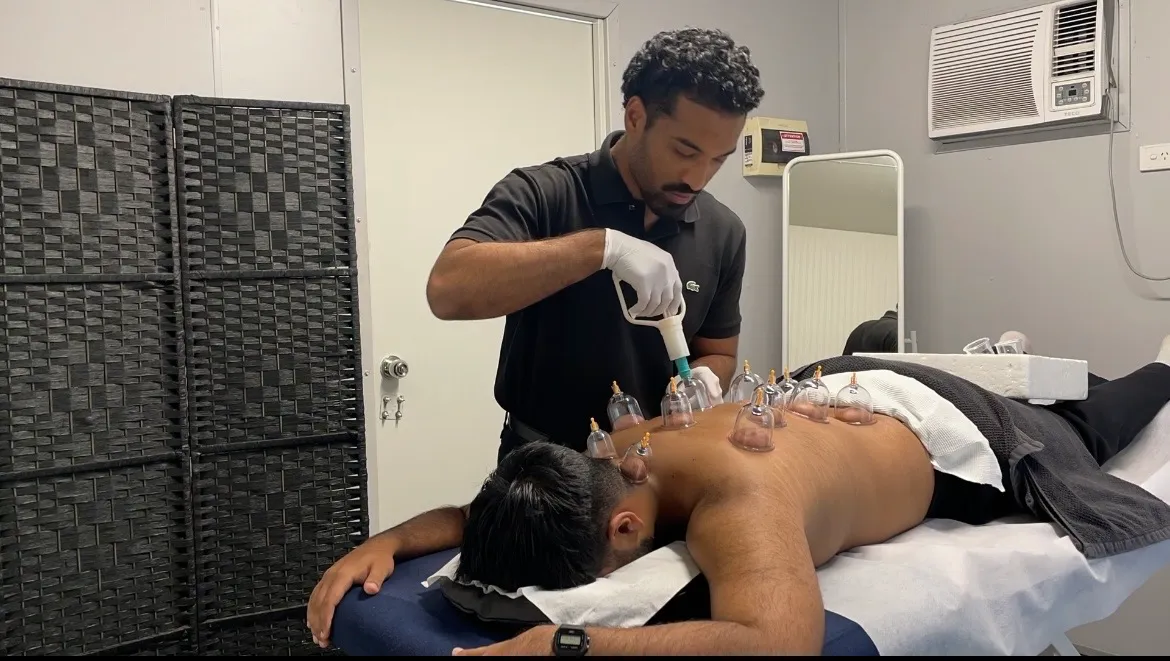 Imaad Karim applying sterile single-use cups during a Hijama wet cupping session